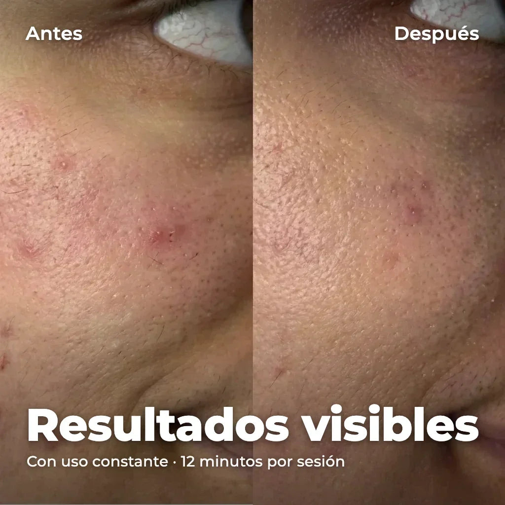 Resultados visibles: antes y después con uso constante
