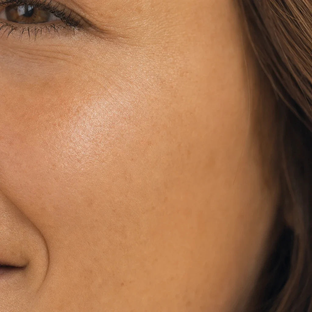 Mejillas más firmes